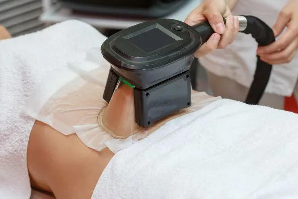 Image of person having fat freezing treatment to help weight gain Bicester