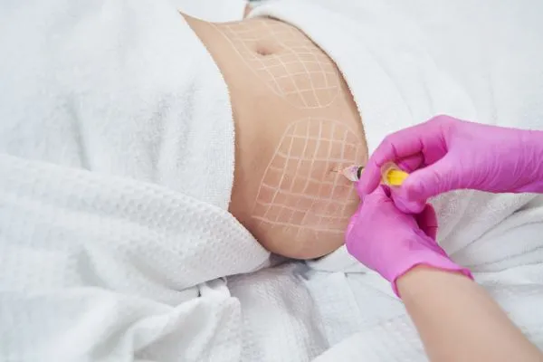 image of fat dissolving injections on love handles to help combat weight gain Bicester