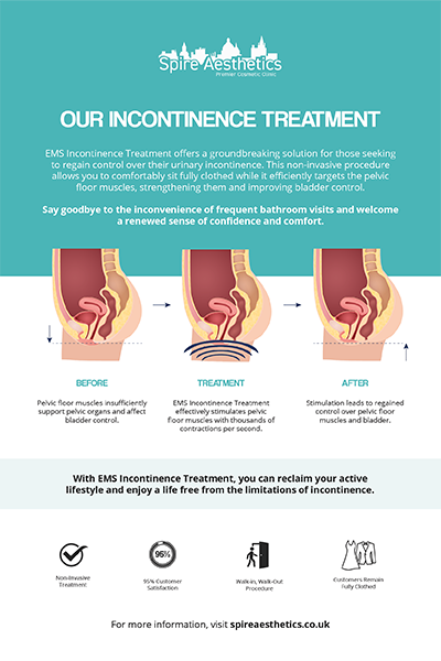 image of how urge incontinence Bicester treatment works