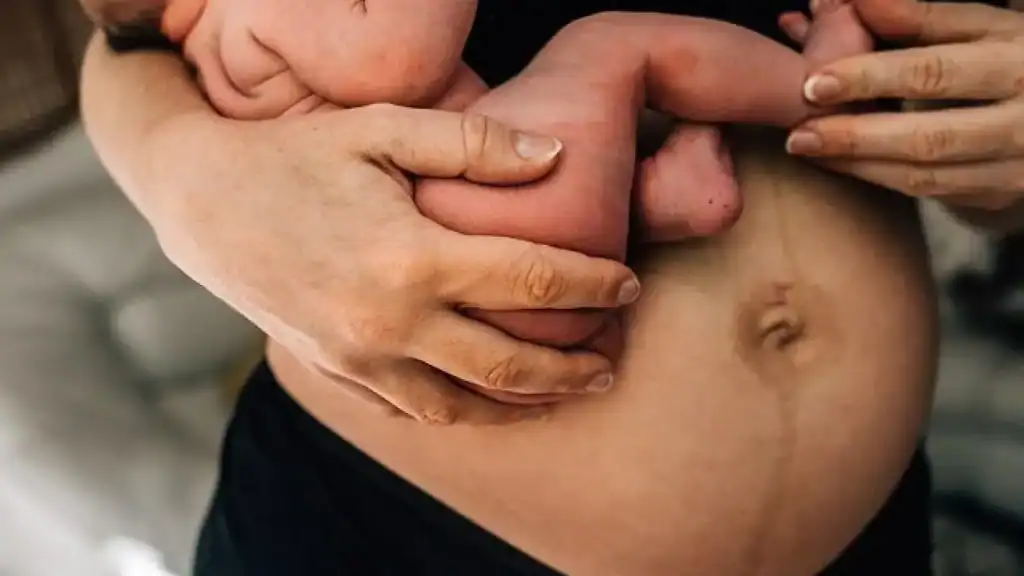 Why Is My Stomach Still Big After Pregnancy Bicester?